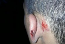 La policía secuestró a un menor en la vía pública, lo golpeó salvajemente y amenazó con violar a su madre