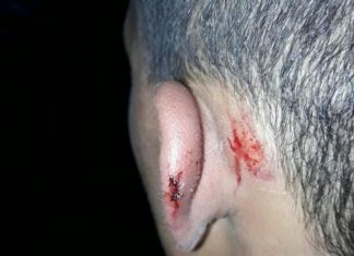 La policía secuestró a un menor en la vía pública, lo golpeó salvajemente y amenazó con violar a su madre
