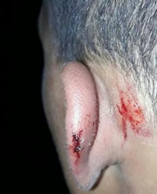 La policía secuestró a un menor en la vía pública, lo golpeó salvajemente y amenazó con violar a su madre
