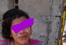 San Martín: tras una discusión, roció a su esposa con alcohol y le prendió fuego